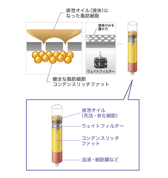 フィルタリング技術による分離