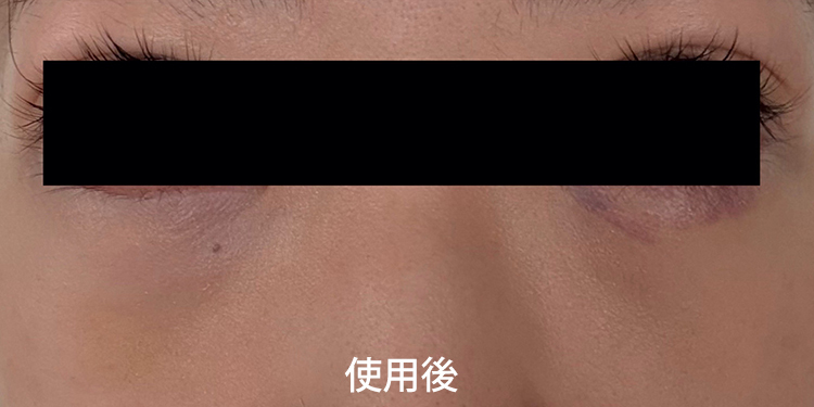使用後
