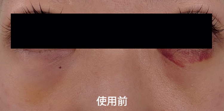 使用前