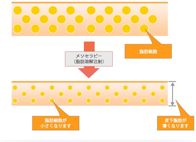 脂肪細胞が小さくなり、皮下脂肪が薄くなります