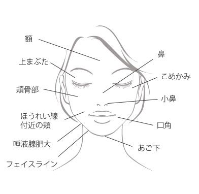 脂肪溶解注射の注入箇所