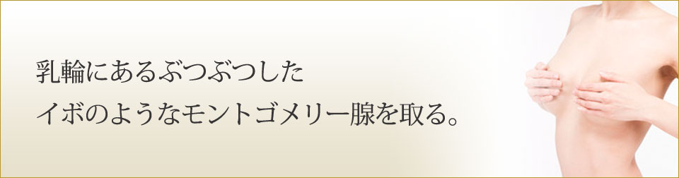 乳輪にあるぶつぶつしたイボのようなモントゴメリー腺を取る。