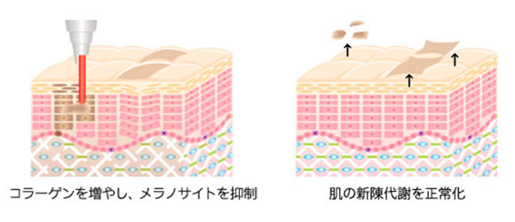 コラーゲンとお肌のイラスト