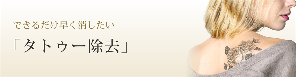 できるだけ早く消したい「タトゥー除去」