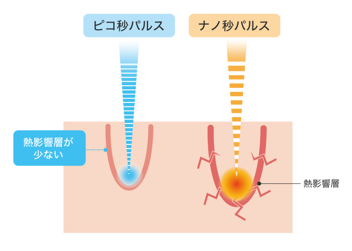 パルスによる違い