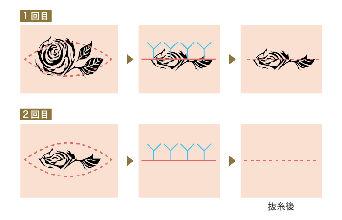 分割切除