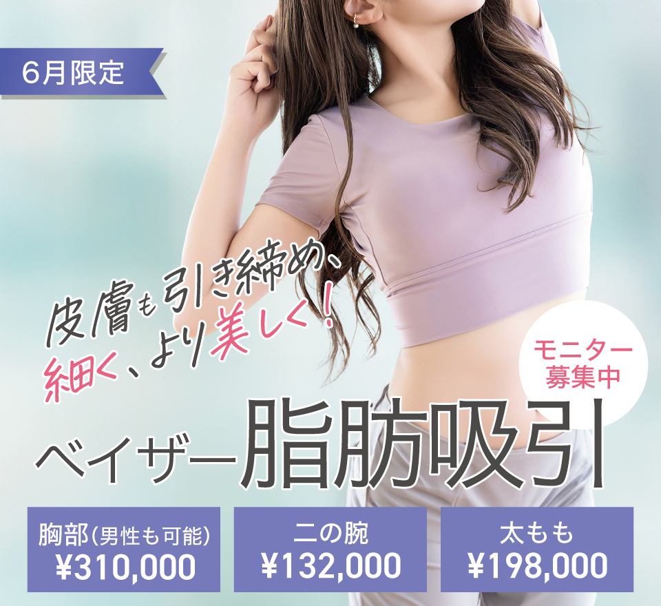 ベイザー脂肪吸引
