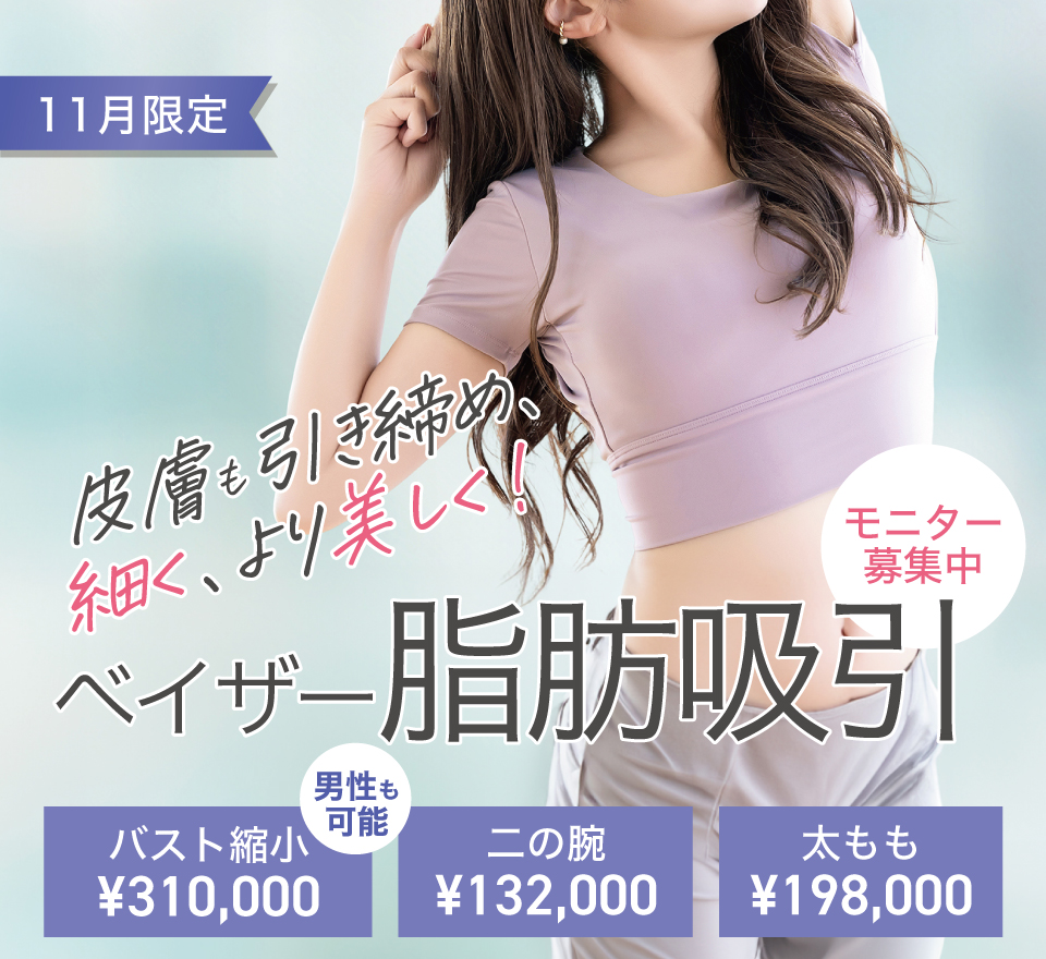 ベイザー脂肪吸引