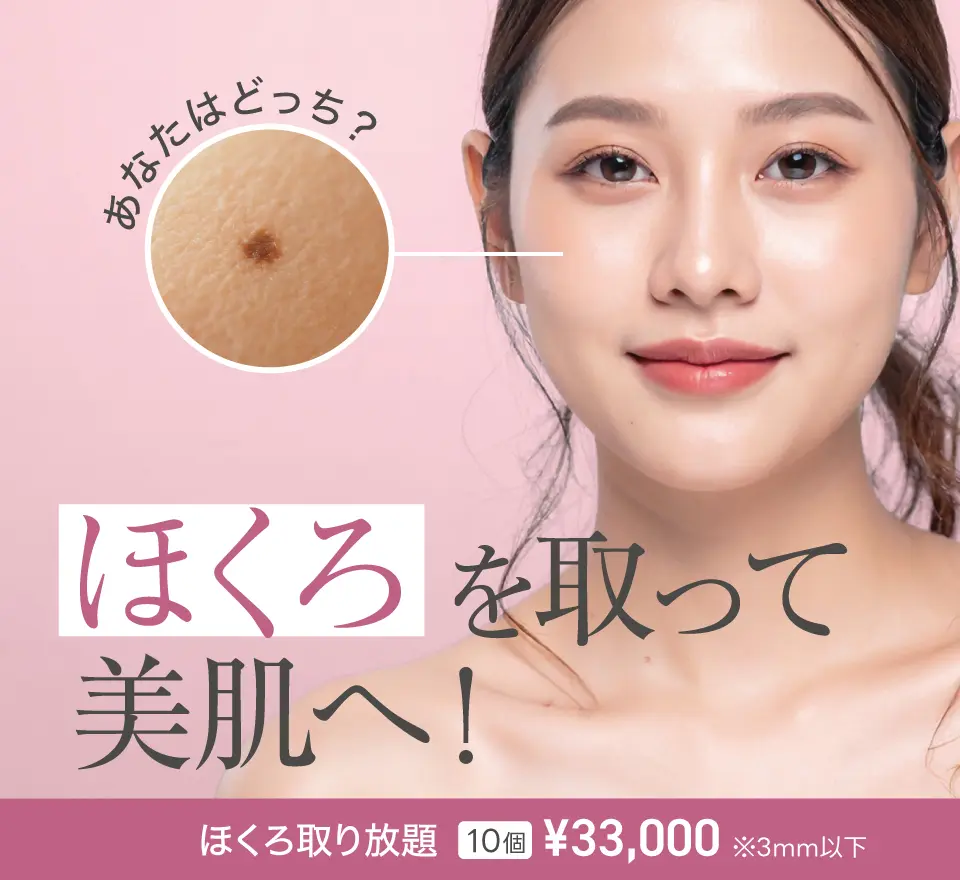 ホクロ取り放題