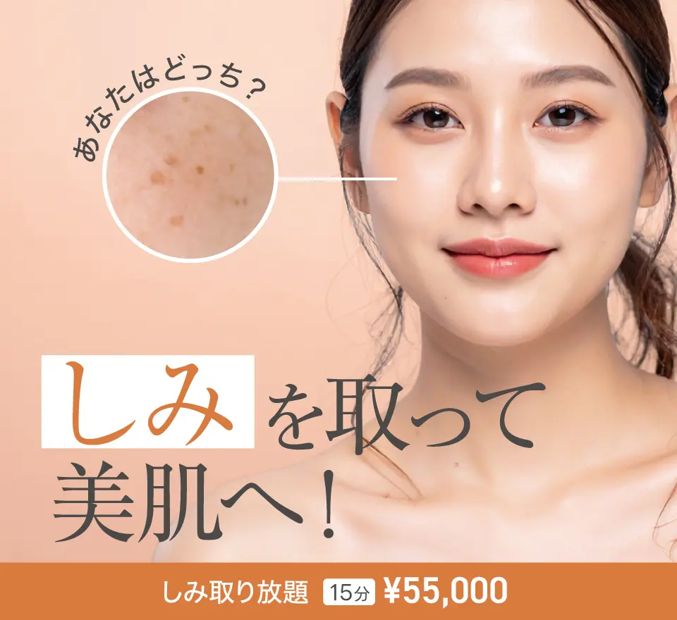 シミ取り放題