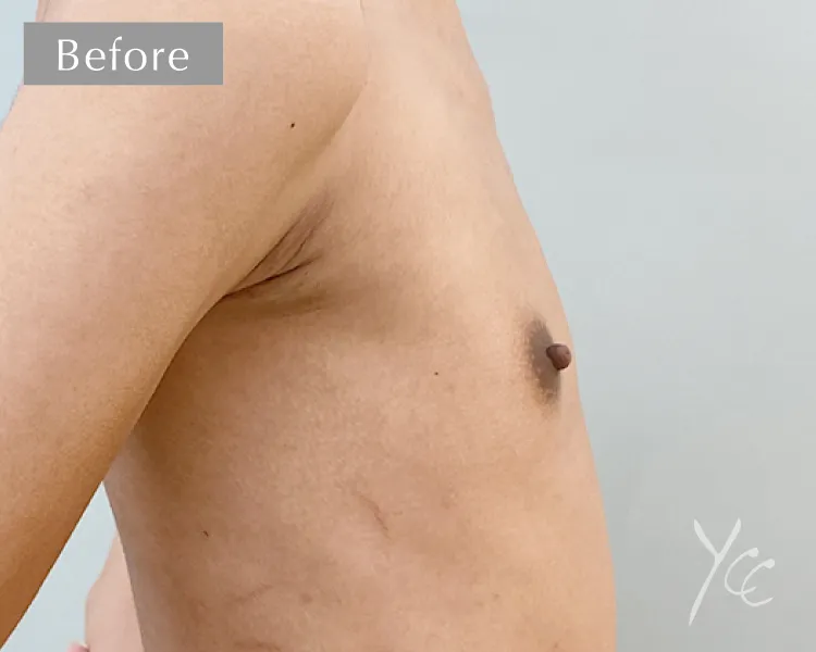 症例13正面施術前