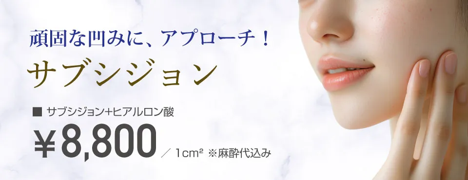 サブシジョン