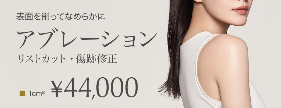 アブレーション