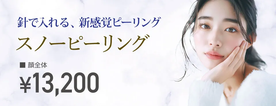 スノーピーリング