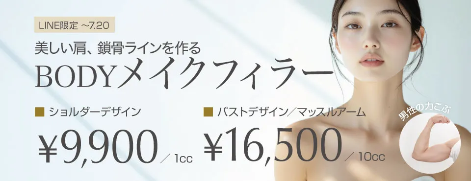 ボディフィラー