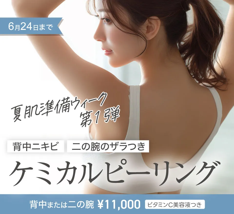 ケミカルピーリング
