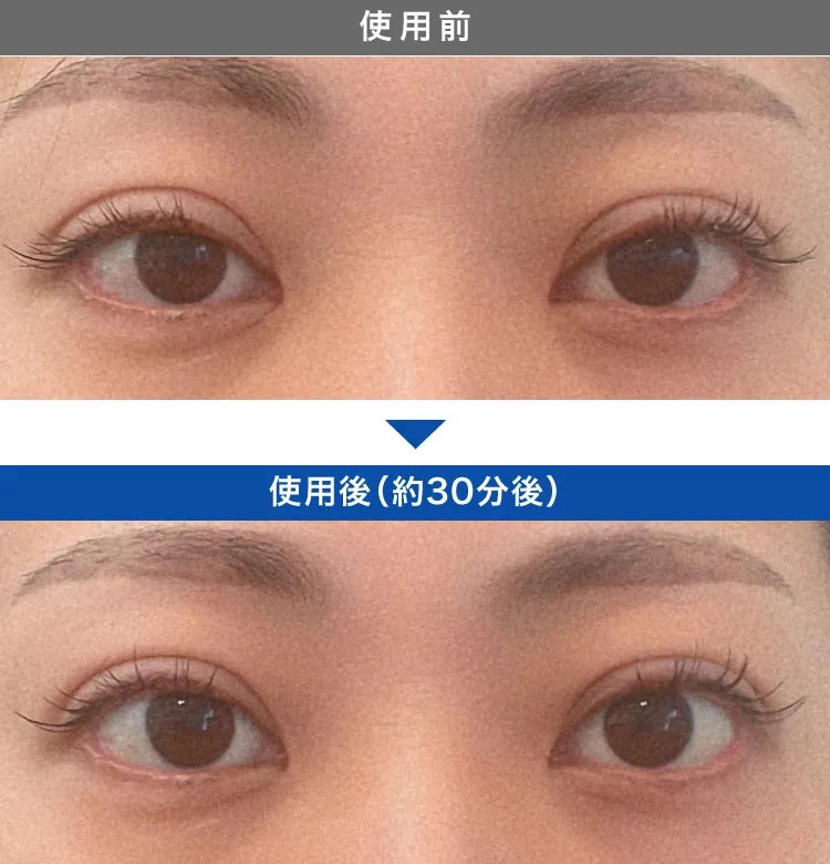 アップニーク症例写真