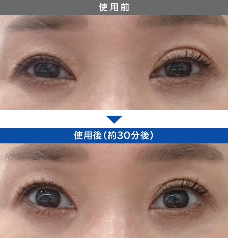 アップニーク症例写真