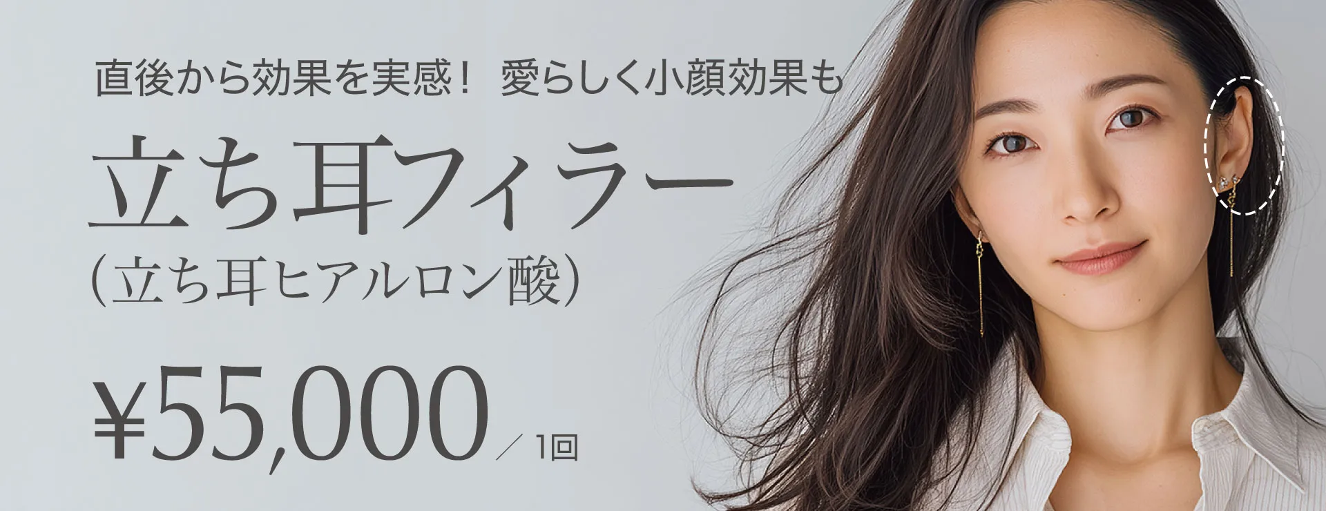 直後から効果を実感!愛らしく小顔効果も 立ち耳フィラー(立ち耳ヒアルロン酸)55,000円