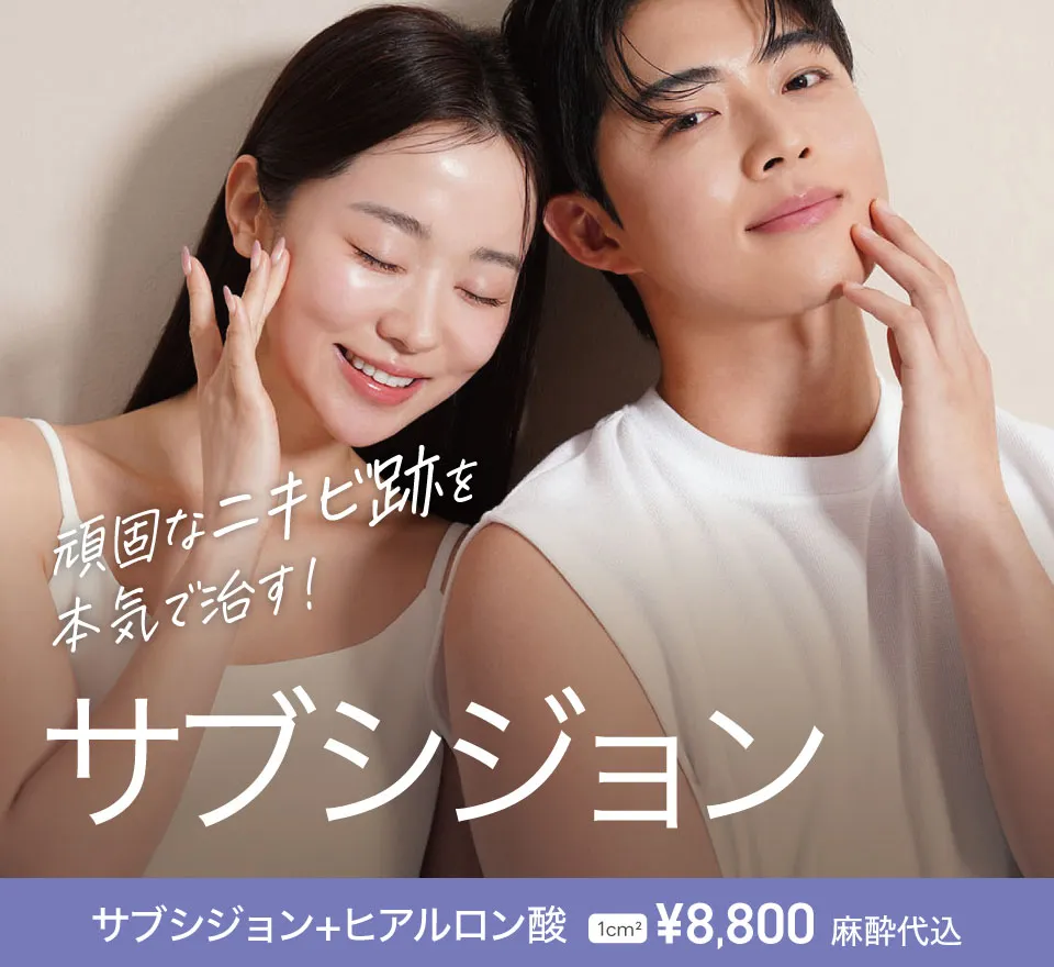 サブシジョン